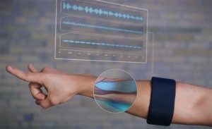 Myo has a built in magnetometer, accelerometer and gyroscope.