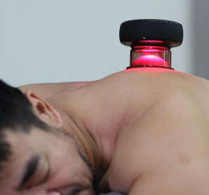 3. Achedaway Cupper Smart Cupping Massager (10)