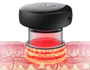 3. Achedaway Cupper Smart Cupping Massager (9)