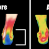 2. Reviiv Light Knee Plus (7)